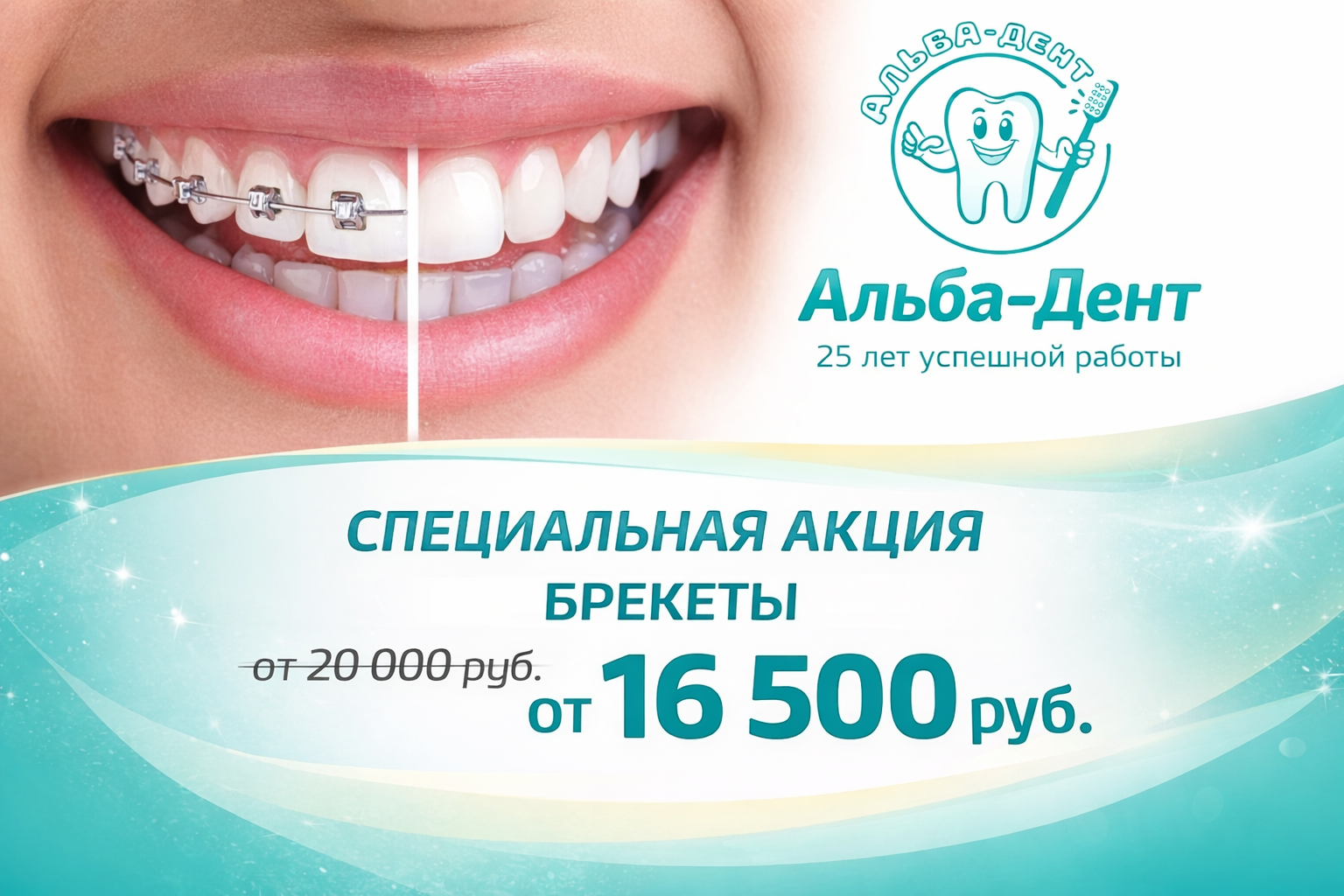 Установка брекетов за 16 500 руб — специальная акция в клинике «Альба-Дент»